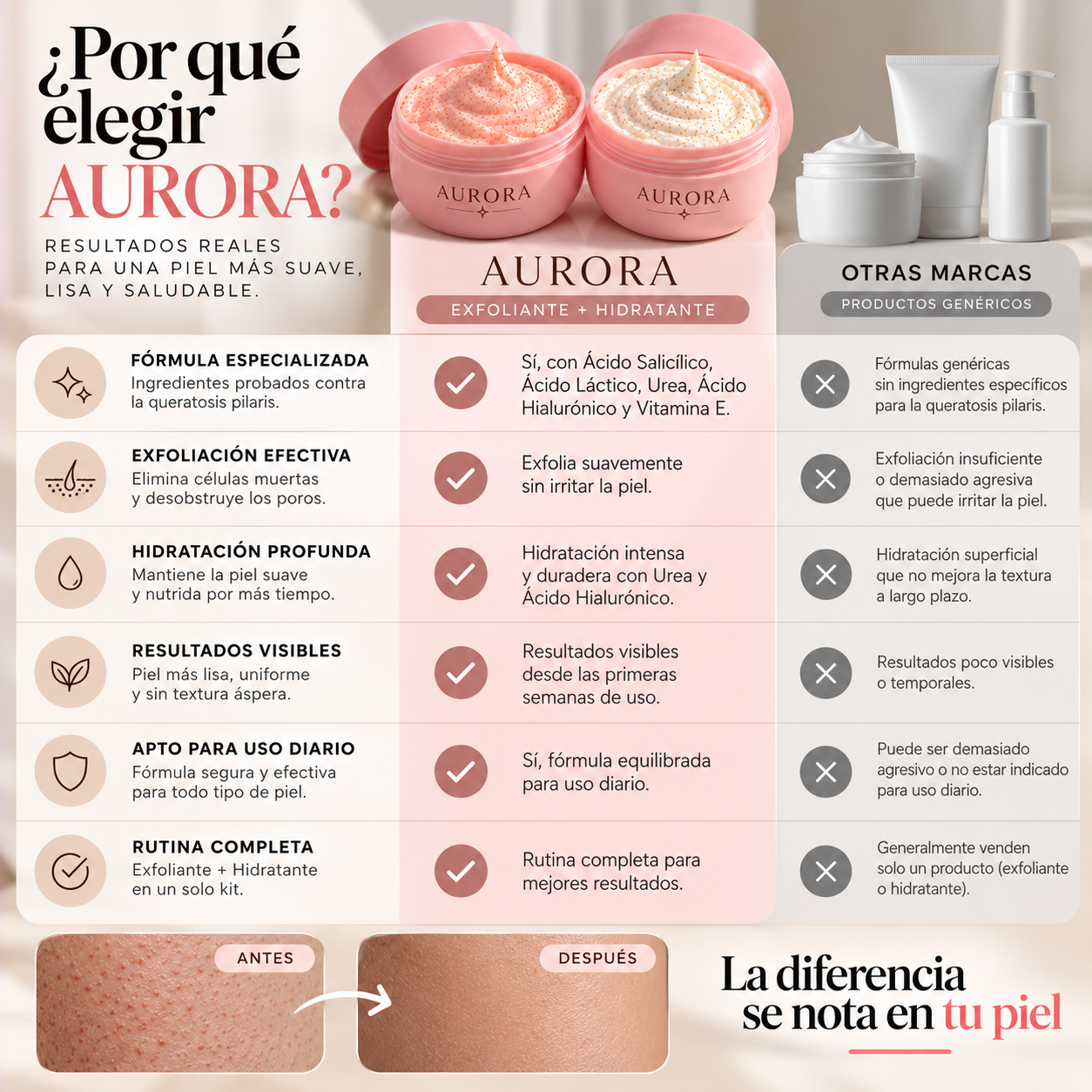 Comparaci&oacute;n entre Aurora y otras marcas